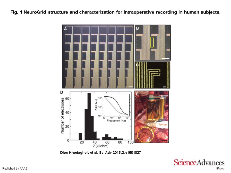 Fig. 1 NeuroGrid structure and characterization for intraoperative recording in human subjects. Dion Khodagholy